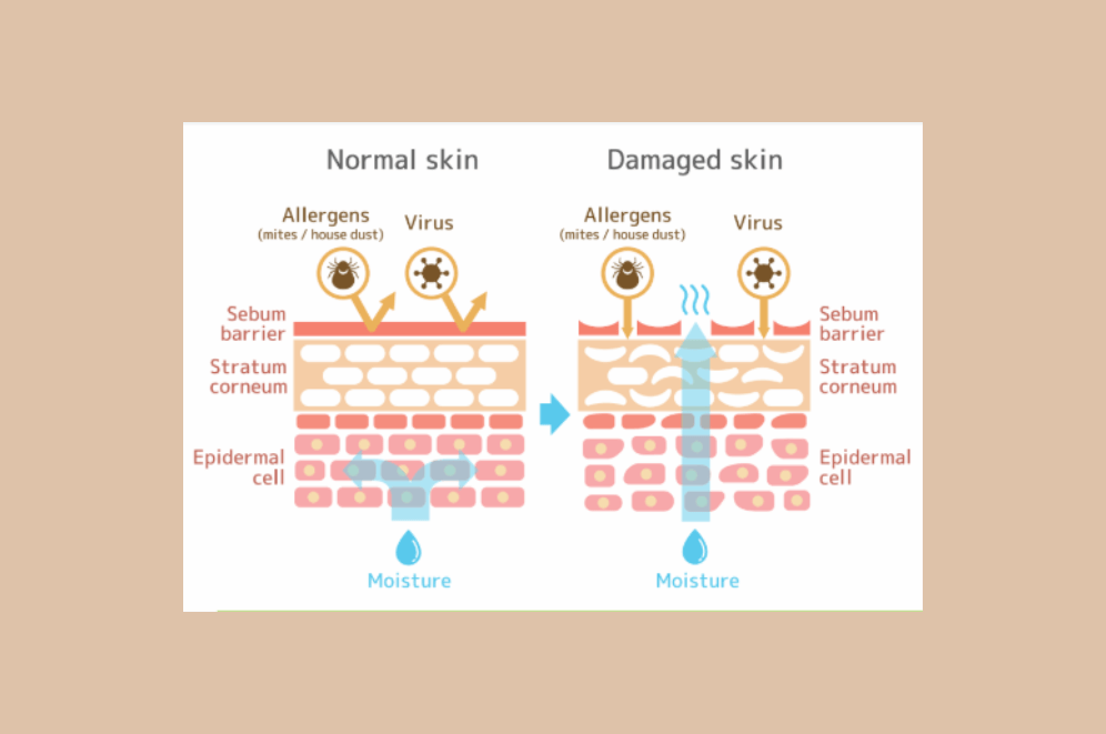 seborroisch_eczeem_voeding